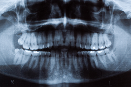 dental xray